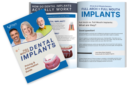 Oliverie Dental Implant Guide