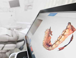 Digital Treatment Planning